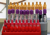 Новое исследование показало, что анализ крови с помощью булавочного укола может выявить заболевание за 10 лет до появления симптомов