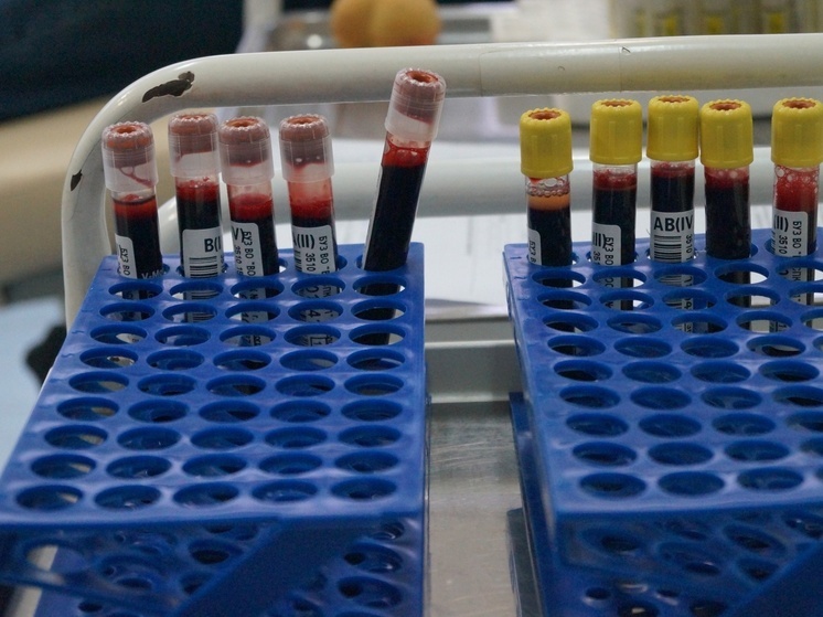 Вологжане в рамках диспансеризации могут сдать анализы на гепатит С