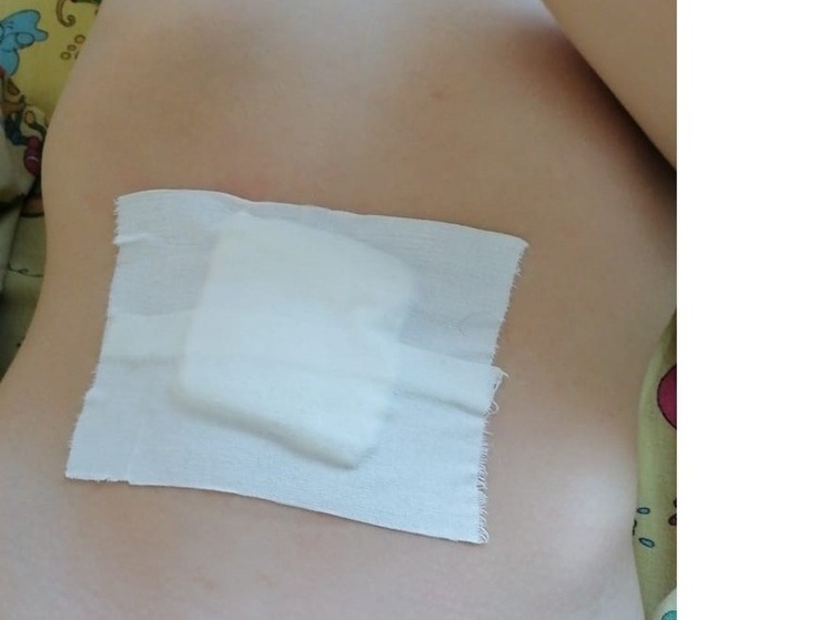 Родители обвинили искитимских врачей в халатности после операции сына