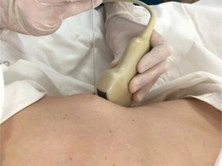 В Орле разработали технологию для мгновенного распознавания рака