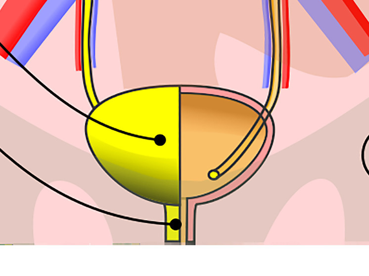 Людям могут начать вживлять импланты вместо мочевого пузыря