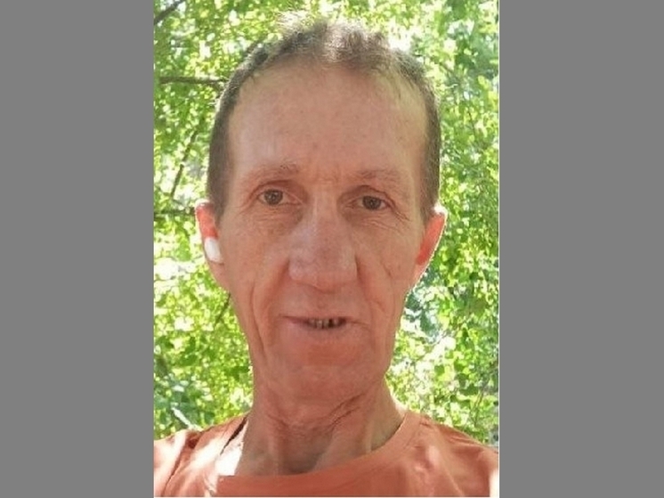 Рыжеволосого без вести пропавшего воронежца ищут два месяца