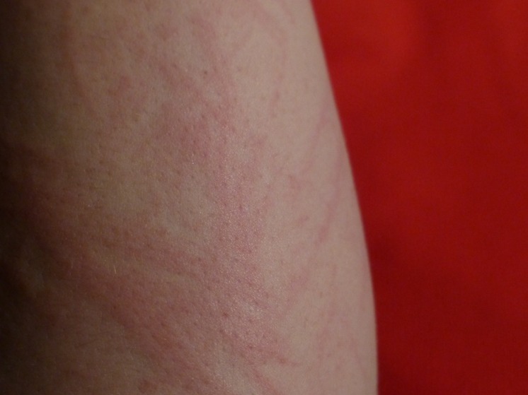 Педиатр Жучкова: аллергия и ЖКТ у воронежских детей