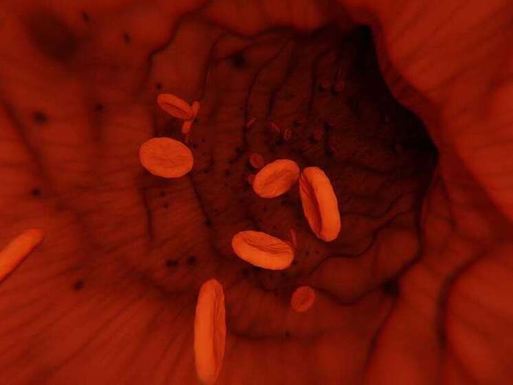 Врач рассказал липчанам о привычках, повышающих риск тромбоза