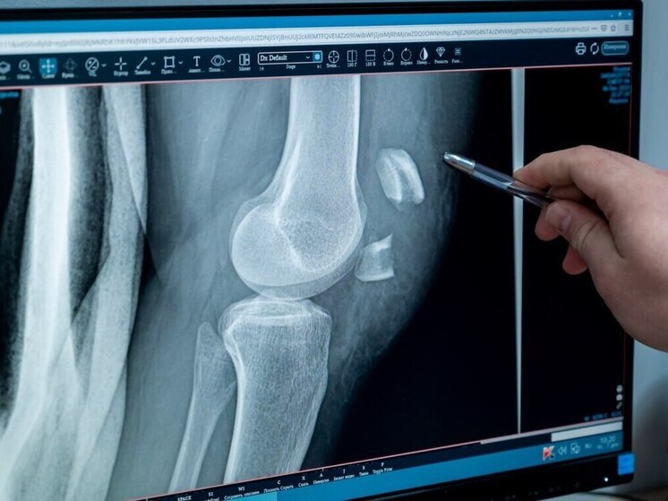 В южноуральском минздраве рассказали, как не получить травму из-за гололёда