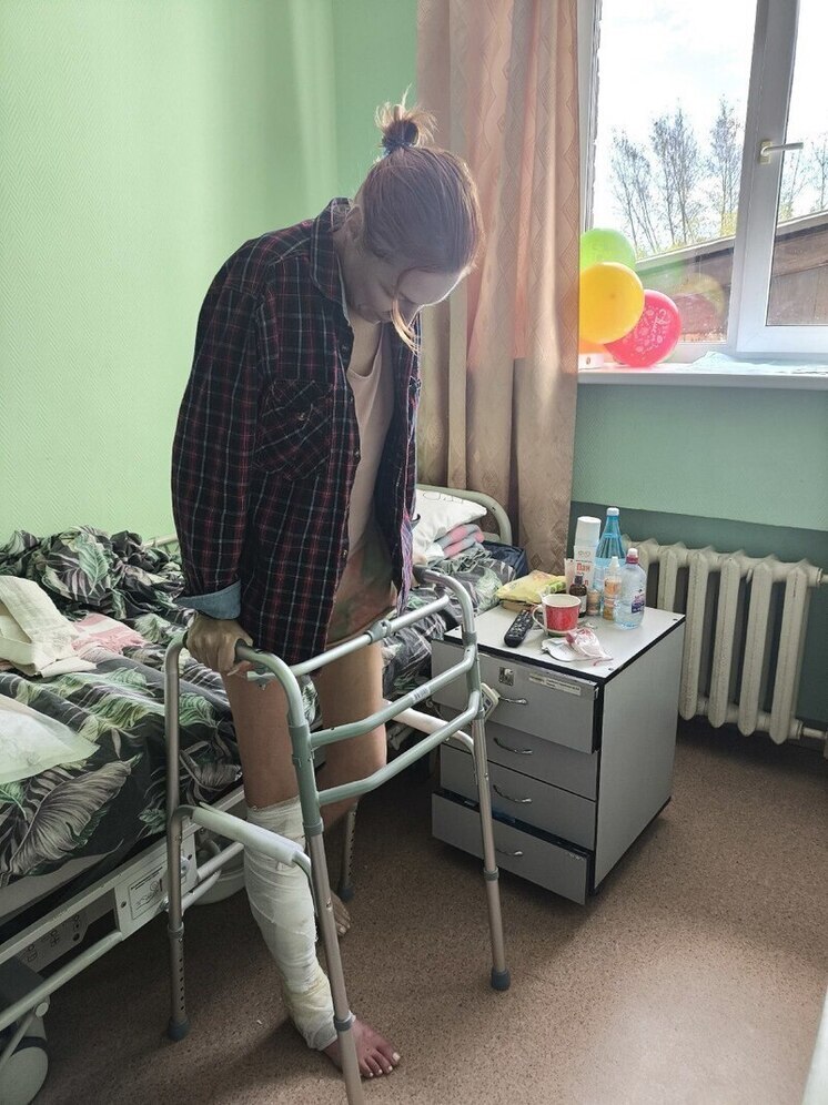 Врачи Екатеринбурга спасли от ампутации покалеченную ногу байкерши
