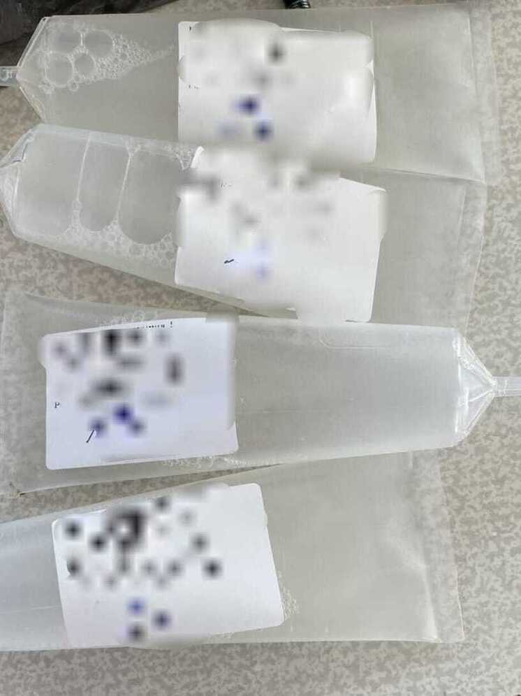 В Орловскую область ввезли более 300 доз генетического материала из Франции