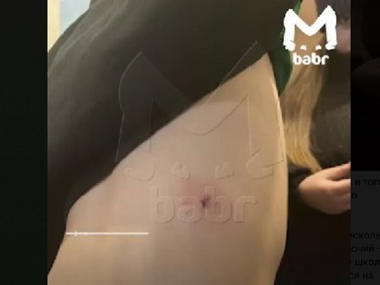 Безнадзорные собаки дважды напали на одного ребёнка в Иркутске