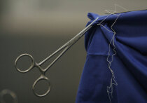 Стоматологическую скобку извлекли из желудка подростка подмосковные эндоскописты