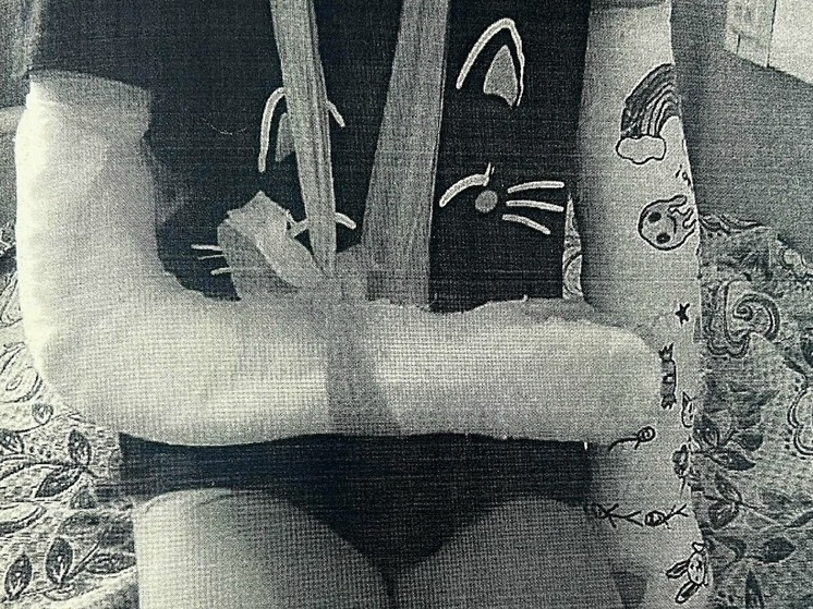 Девочка сломала обе руки на набережной Благовещенска – родители обратились в суд