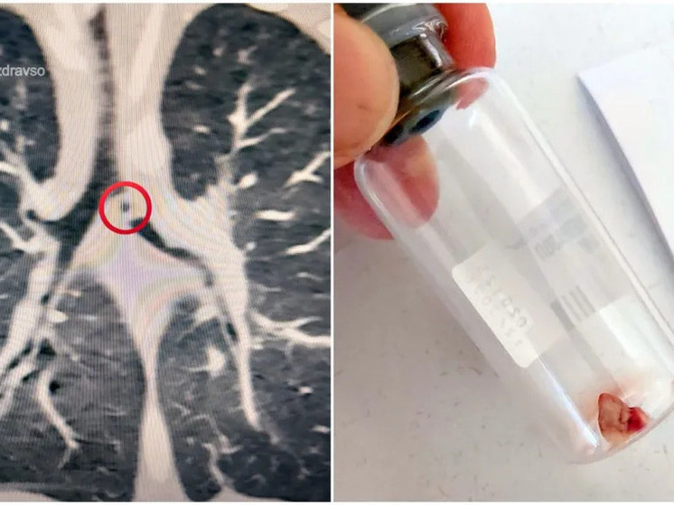 Малыш из Екатеринбурга чуть не задохнулся после того, как съел глину