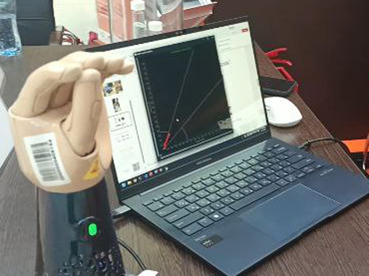 По-новому управлять бионический рукой предложили людям, потерявшим конечности, учёные Сколтеха