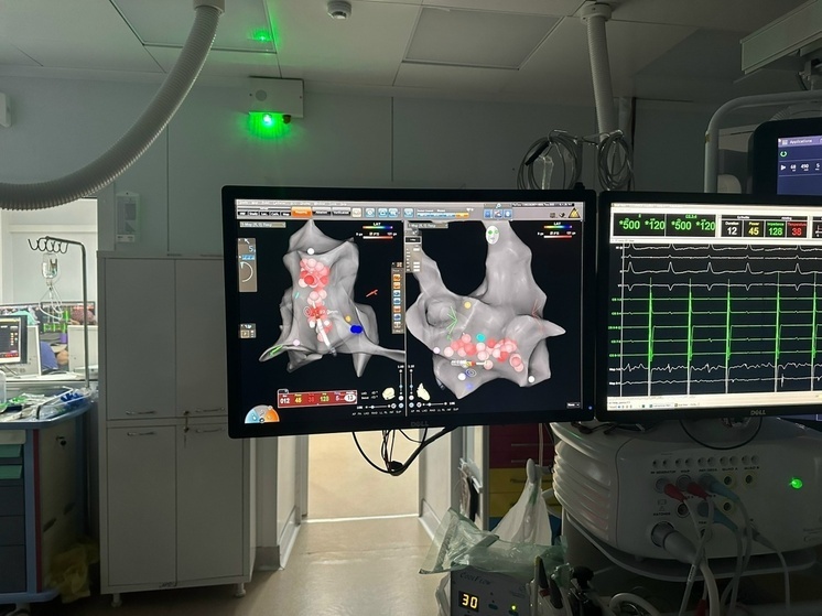 Калужские медики впервые начали проводить РЧА