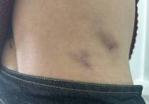 В Горно-Алтайске 34-летний местный житель жестоко избил жену после шумного застолья