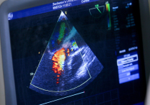 Несмотря на постепенное снижение смертности от сердечно-сосудистых заболеваний (ССЗ), они остаются главной причиной смертности во всем мире
