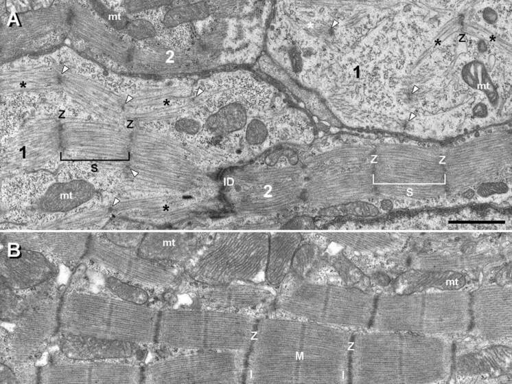 Ученые из Пущино нашли новый маркер для изучения структуры сердечной мышцы