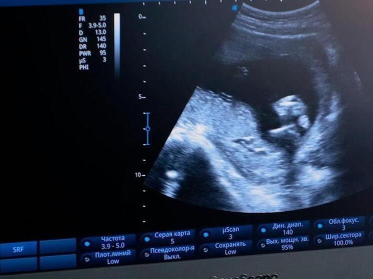 Новосибирский врач рассказал, как снизить риск передачи ВИЧ от матери к ребёнку