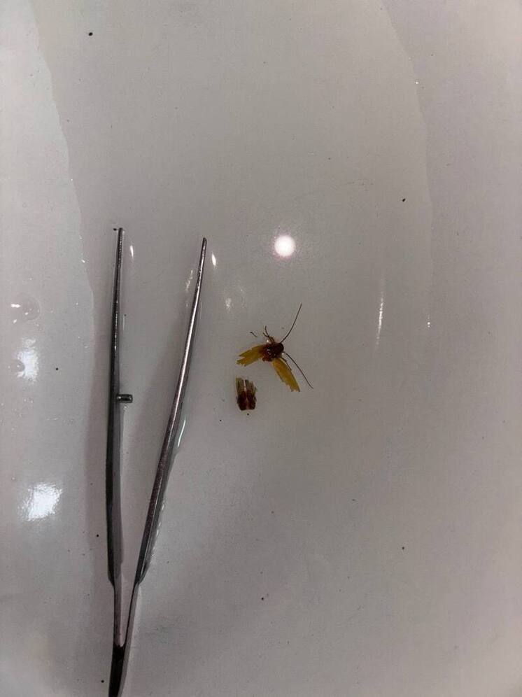 В Чувашии врачи спасли подростка от опасного инородного тела в ухе