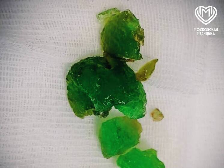 Врачи спасли девочку, проглотившую гелиевый шар