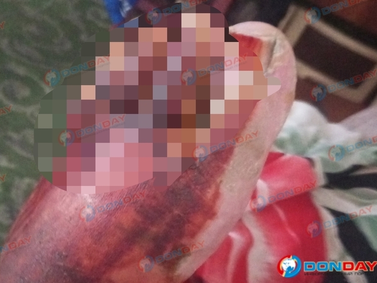 Пострадавший от группового избиения  житель Новочеркасска не может добиться возбуждения дела