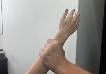 В Барнауле ужин супругов закончился ссорой и закрытым переломом