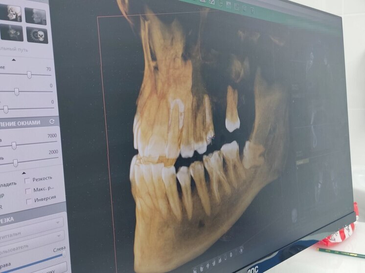 Стоматологи рассказали, что осанка влияет на здоровье зубов