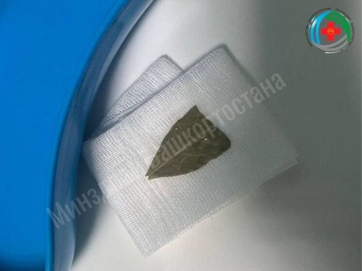 Жительница Башкирии едва не задохнулась, проглотив лавровый лист