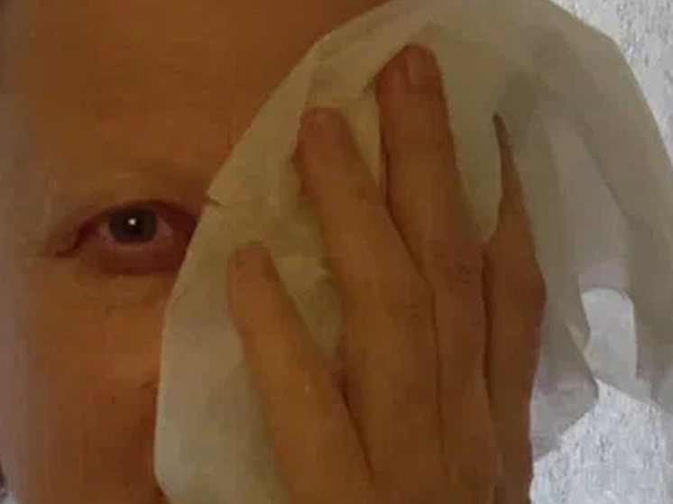 Врач Зарубин: не следует тереть глаз при попадании пробки от шампанского