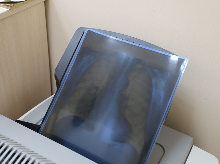 Главный онколог Пензенской области предупреждает: до 90% смертей от рака легких связаны с курением