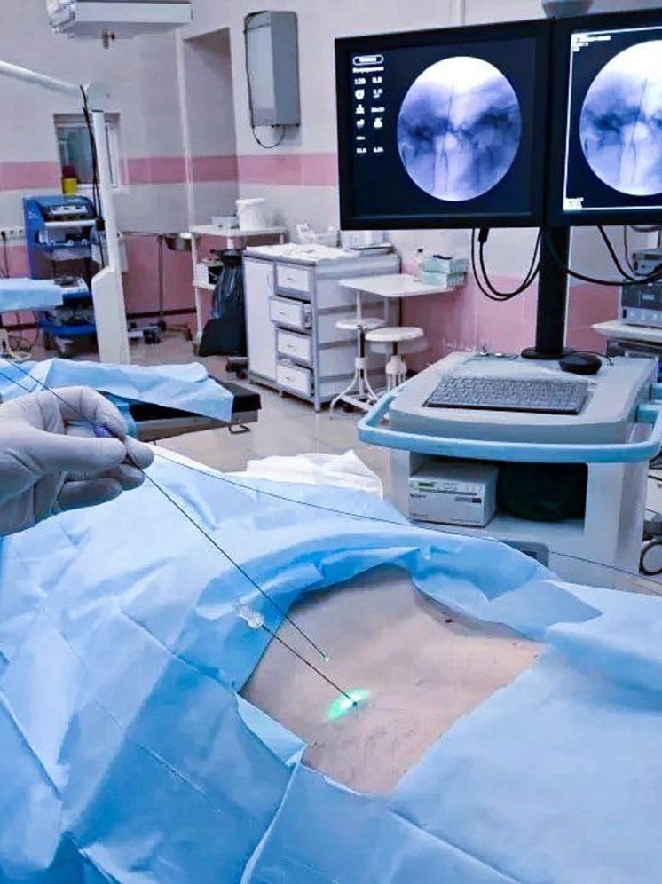 Лечить межпозвоночные грыжи у нижегородцев будут с помощью лазера