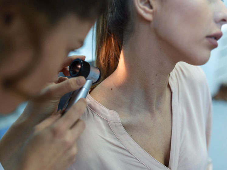 Бесплатно проверить родинки предлагают жителям Кировской области