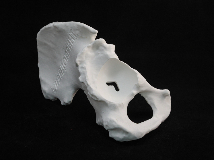 ISSCR: Новый препарат SN101 впитывает боль в суставах как «биологическая губка»