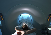 Онкологи Сеченовского университета разработали новую классификацию рака ротоглотки