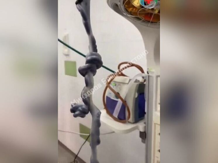 В Уфе родился младенец с 150-сантиметровой пуповиной