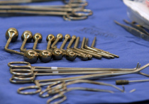 Под насморк замаскировалась опухоль у основания черепа, которую обнаружили у пенсионера подмосковные врачи