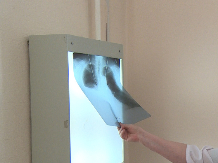 В новосибирской школе №112 выявили шесть случаев заболевания туберкулёзом