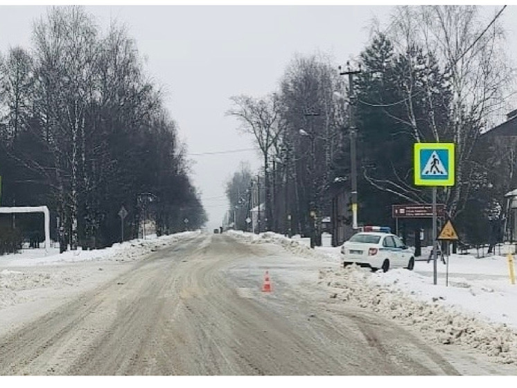 Три пешехода пострадали от наезда автомобилистов на Вологодчине