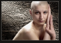 История выпадения волос знакома многим женщинам: сначала несколько волосков в сливе душа, затем все более заметные просветы, особенно на висках и проборе