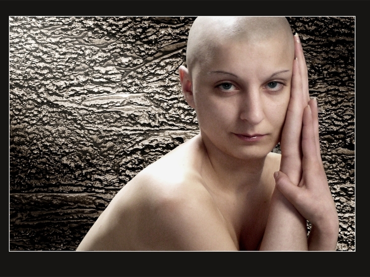 Врачи объяснили, почему женщины стали лысеть чаще