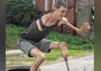 Инвалида I группы детства Тимура Шаповалова  в тюремной больнице  в Волгограде искусали  клопы