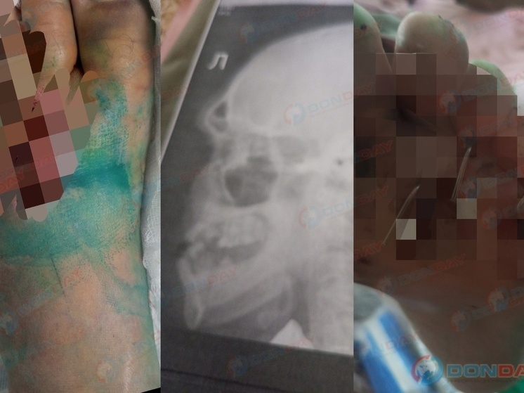 В деле об избиении жителя Новочеркасска пропали важные вещдоки