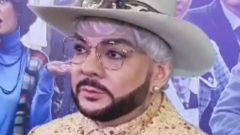 Филипп Киркоров признался, что ходит к косметологу 