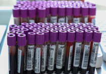 Анализ крови может предсказать, кто больше всего подвержен риску развития распространенных наследственных заболеваний сердца