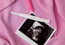 Женщина из Калифорнии родила здорового ребенка после "неслыханной" внематочной беременности, сообщает The Guardian