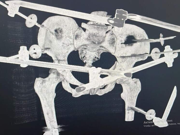 На трассе Владивосток — Хабаровск спасли жизнь молодой девушке после ДТП