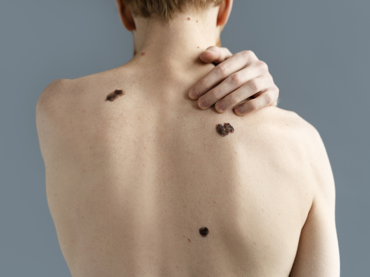 В Самаре детям могут начать делать прививки от вируса папилломы с 2027 года