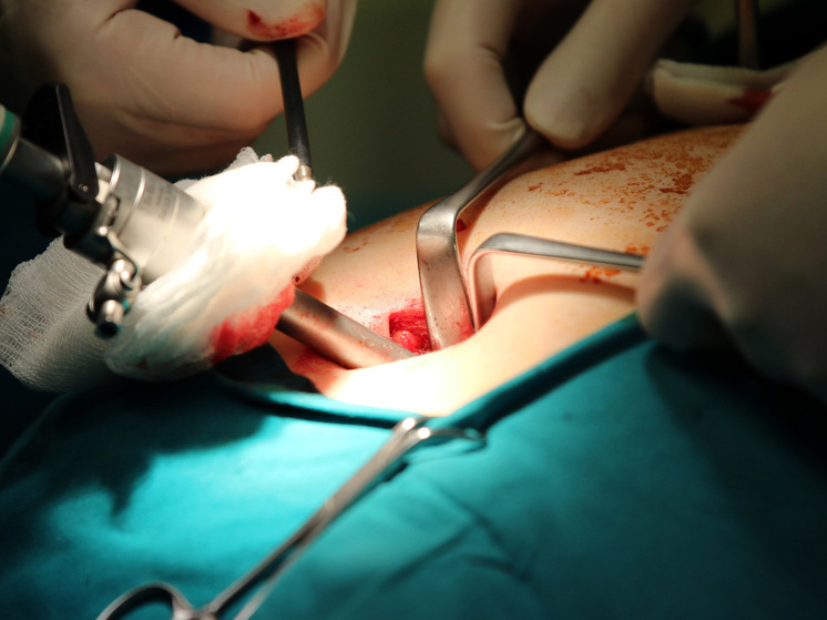 Жителю Нижнего Новгорода одновременно пересадили печень и удалили опухоль желудка