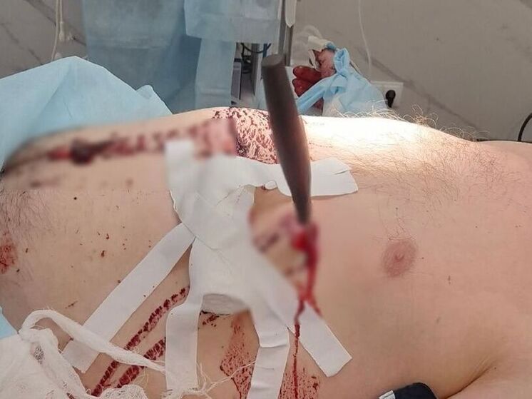 В Удмуртии врачи спасли жизнь пациенту с ножевым ранением в сердце