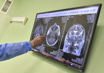 Самый молодой человек, у которого в Великобритании диагностировали деменцию, умер в возрасте 24 лет