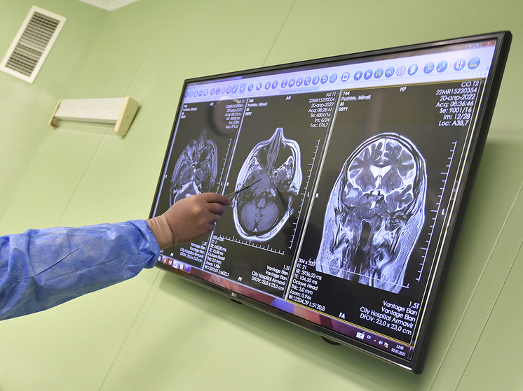 В Великобритании умер самый молодой пациент с диагностированной деменцией